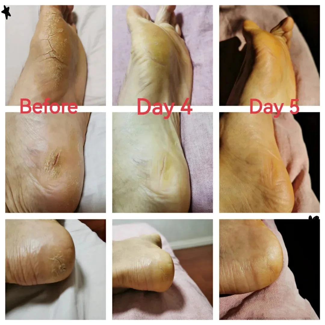 Traditional Clam Oil Anti-Drying Crack Foot Moisturize Cream Hand Heel Cracked Repair Removal Dead Skin Callus Care Mask