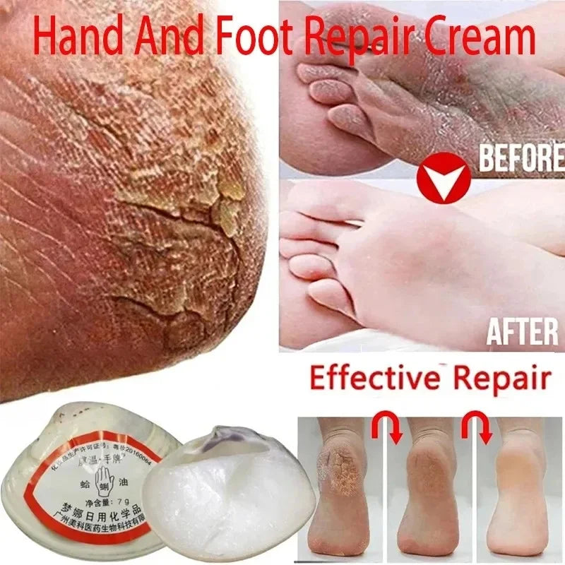 Traditional Clam Oil Anti-Drying Crack Foot Moisturize Cream Hand Heel Cracked Repair Removal Dead Skin Callus Care Mask